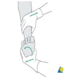 External Rotation Stress Test: