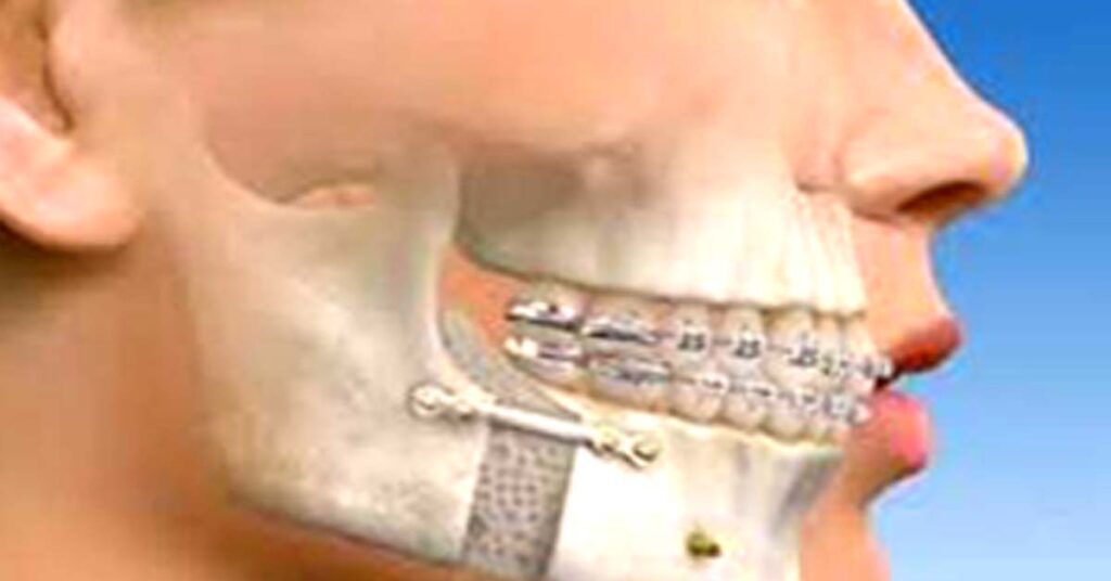 Jaw area - Maxillofacial Surgeon