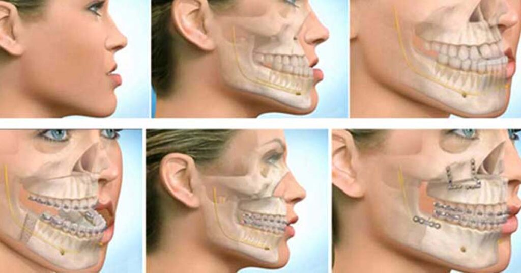 What is the meaning of maxillofacial surgery?