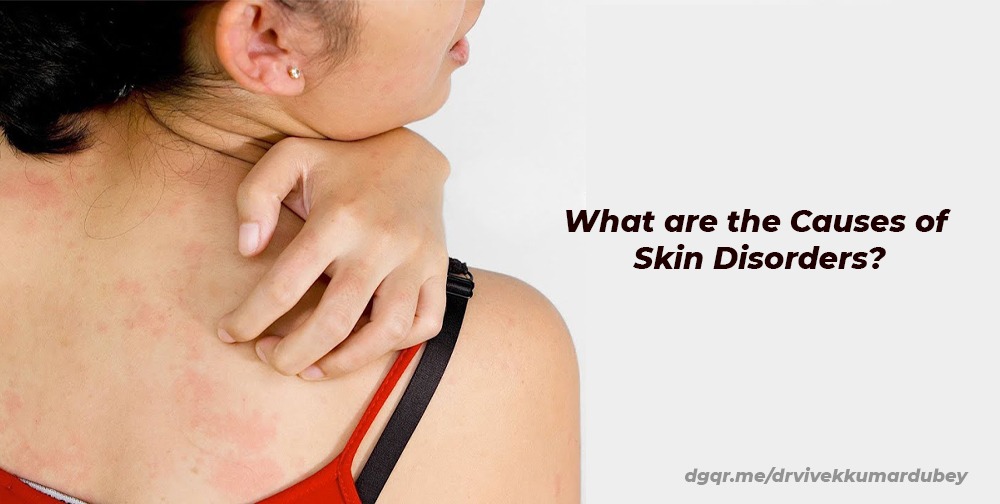 What are the Causes of Skin Disorders?