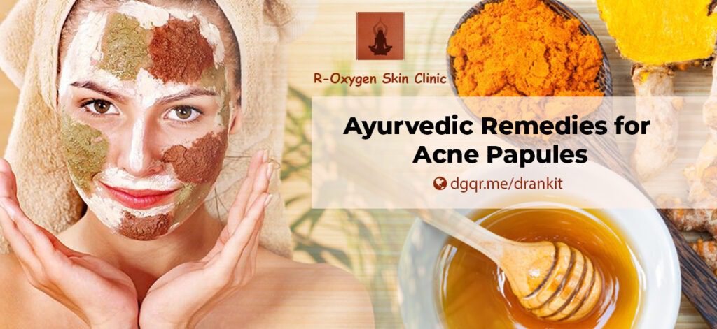 Ayurvedic Remedies for Acne Papules