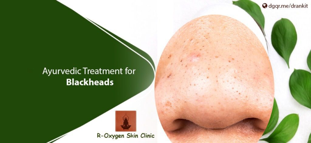 AyurvedicTreatments_Blackheads