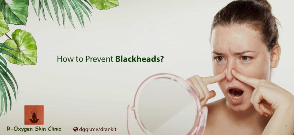 HowPreventBlackheads