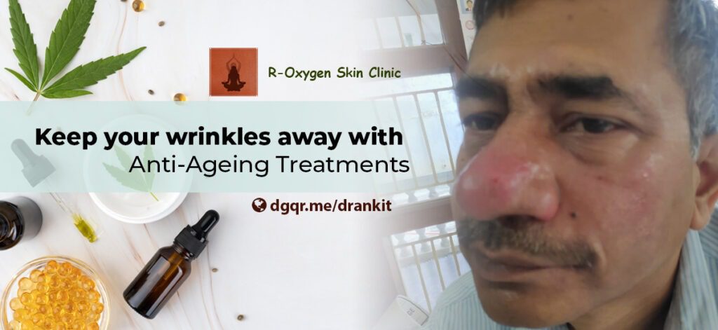 Anti Ageing Treatment