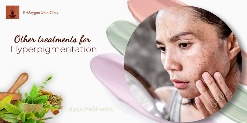 Other treatments for hyperpigmentation